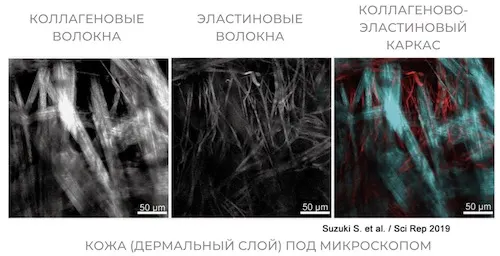 Эластин и коллаген связаны между собой и образуют сетчатый каркас